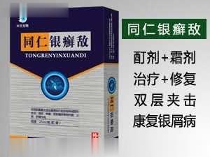 同仁百癣净乳膏