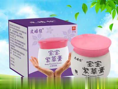 皮蝳经宝宝紫草膏