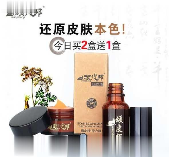 皮肤病产品招商顽皮邦炎力消专治皮炎