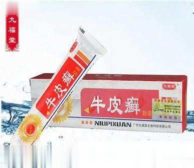 牛皮癣——皮肤抑菌
