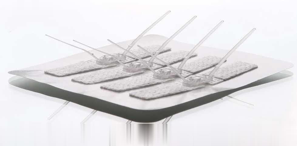 一次性皮肤缝合器---医用缝合拉扣