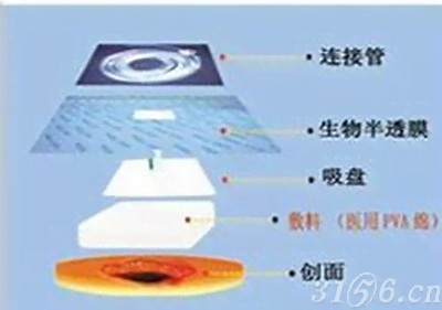 快舒负压引流海绵（VSD）