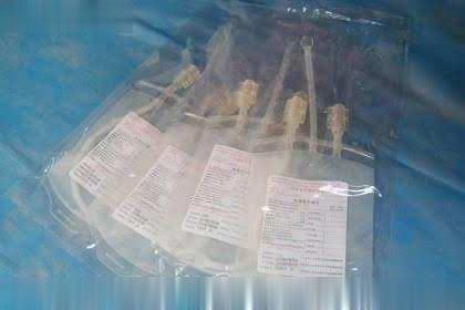 一次性使用臭氧大自血专用血袋